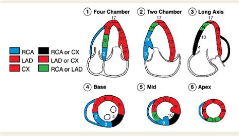 lv wall motion abnormalities.